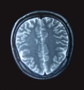 Walking Machine May Help Brain Injured Vets