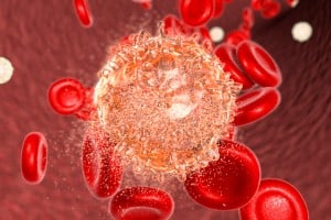 Pediatric Leukemia Patients in China at Risk after Deadly Outbreak of mcr-1 Klebsiella