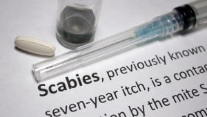 Scabies Outbreak at Florence, SC Retirement Home Is Being Investigated by the DHEC