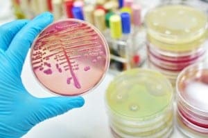CDC Warns of Widespread Legionnaires in Hospitals throughout the U.S.
