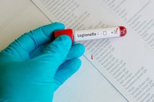 Legionnaires’ Risk for Patient in Health Care Facilities
