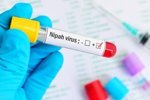 Dangerous Nipah Virus Poses Risk Worldwide