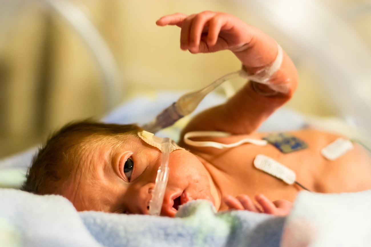 Injured Baby At Hospital