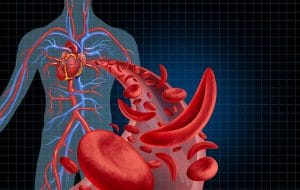 Sickle Cell Disease, Cystic Fibrosis & Disparities in Federal Funding