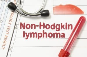 Non-Hodgkin’s Lymphoma and the Link to Camp Lejeune